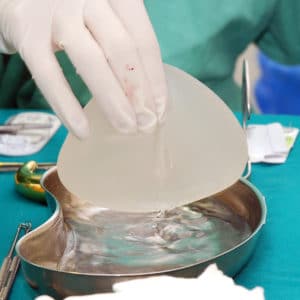 Medical assistant holding breast implants